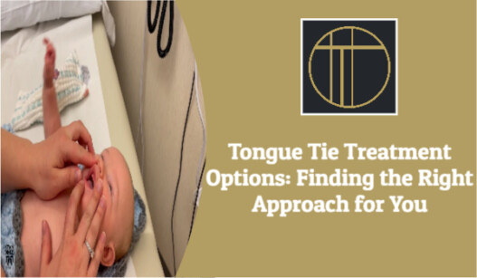 Tongue Tie Treatment