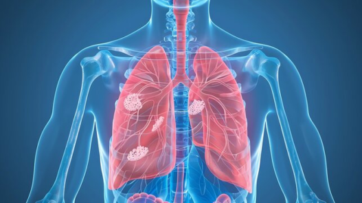 respiratory infections